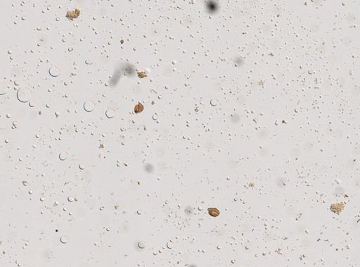 Diphyllobothrium canis