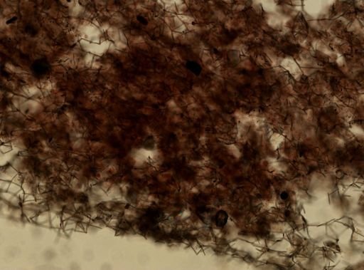 Haliclona