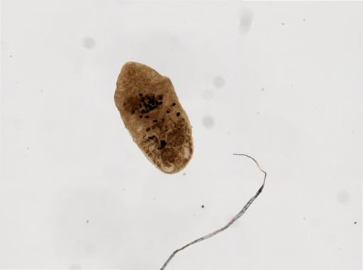 Metagonimus yokogawai