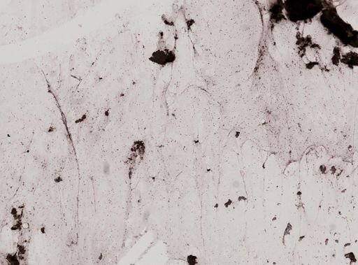 Giardia lamblia