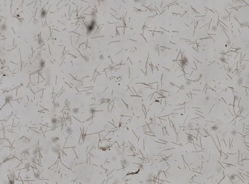 Amphimedon compressa