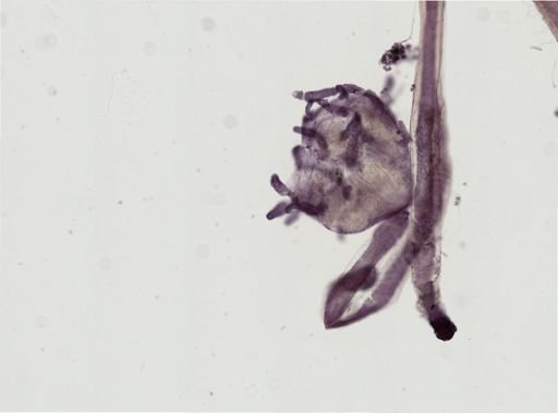 Vorticella