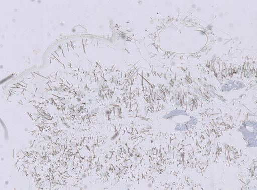 Stromatospongia vermicola