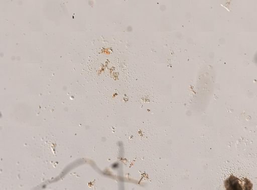 Epitomapta roseola