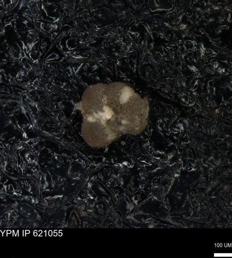 undet. Rugoglobigerinidae
