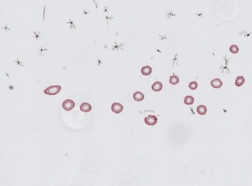 Edwardsia sp.