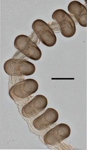Physalia physalis