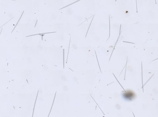 Stelletta sp.