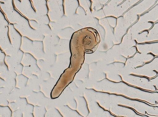 Enterobius vermicularis