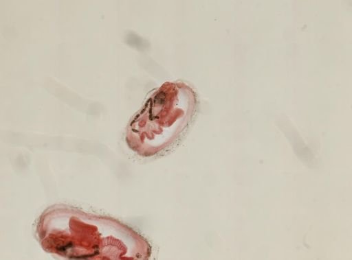 Ostracoda?