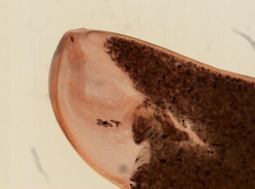 Oligacanthorhynchus microcephalus
