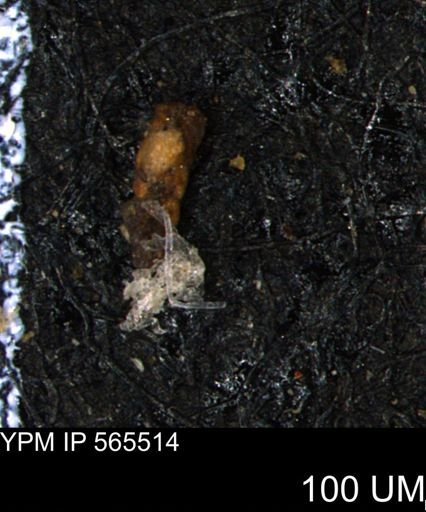 Verneuilina canadensis
