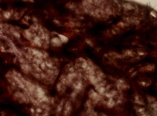 Axinellidae