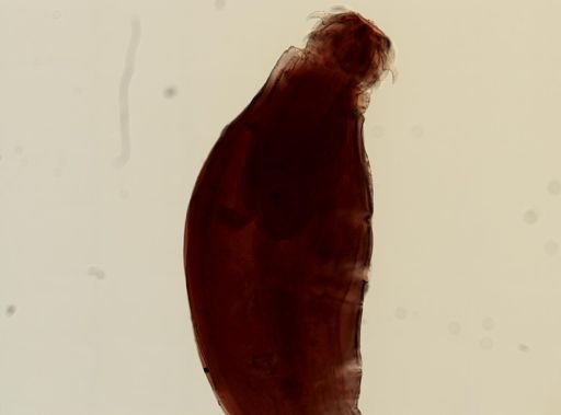 Macracanthorhynchus ingens