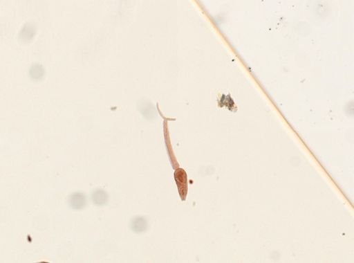Schistosoma mansoni