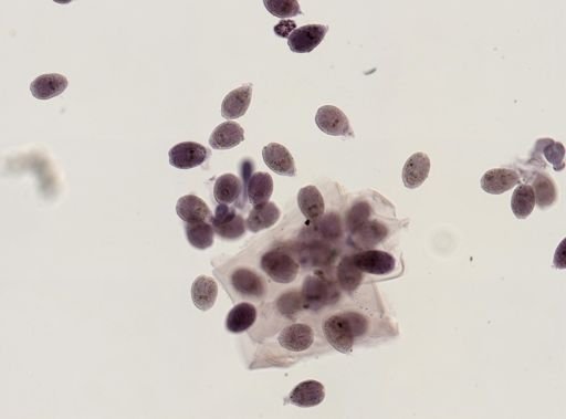 Echinococcus