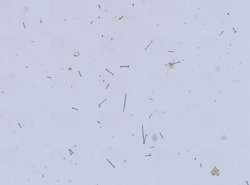 Anheteromeyenia argyrosperma