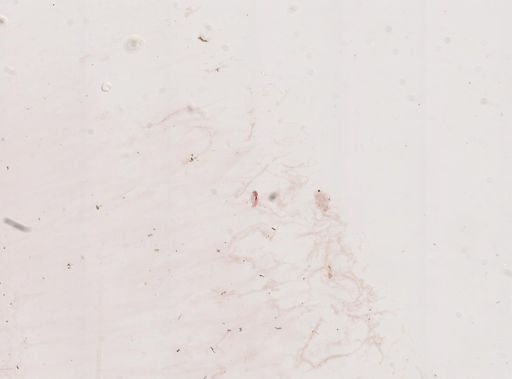 Paramecium