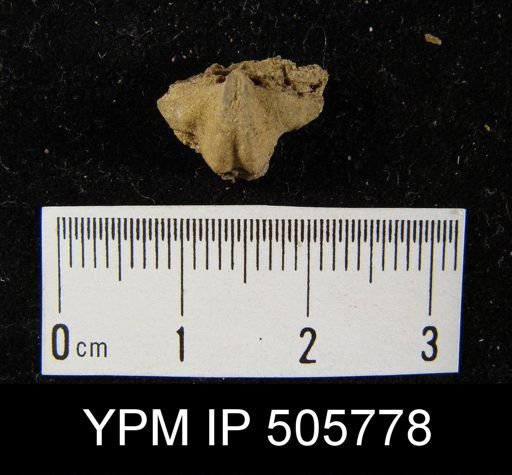 Metaplasia pyxidata