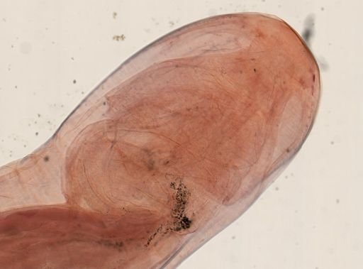 Oligacanthorhynchus microcephalus