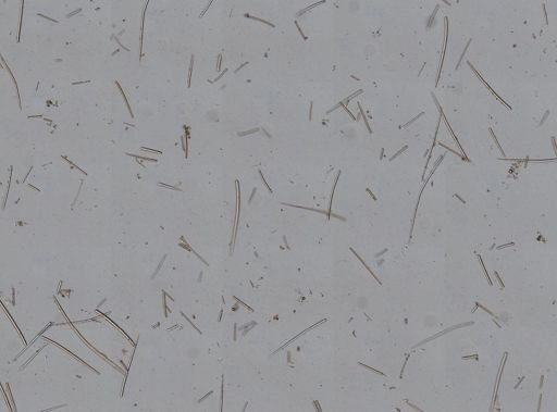 Ptilocaulis walpersii