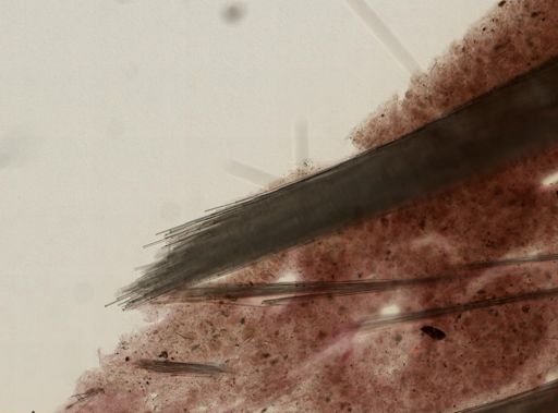 Tentorium semisuberites