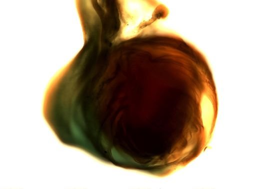 Taenia solium