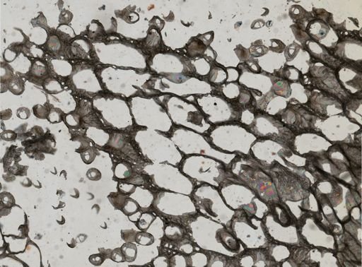Rhynchozoon rostratum