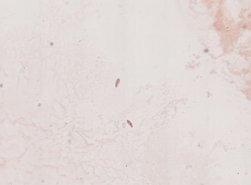 Paramecium