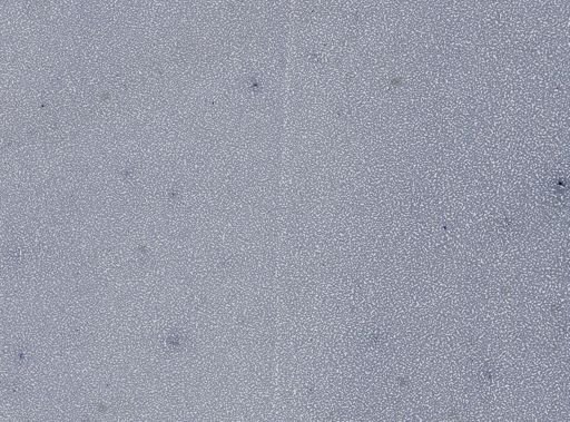 Plasmodium vivax