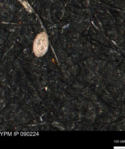 Spirolocammina planula