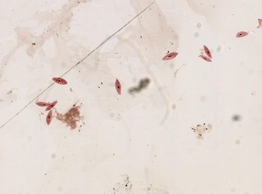 Paramecium