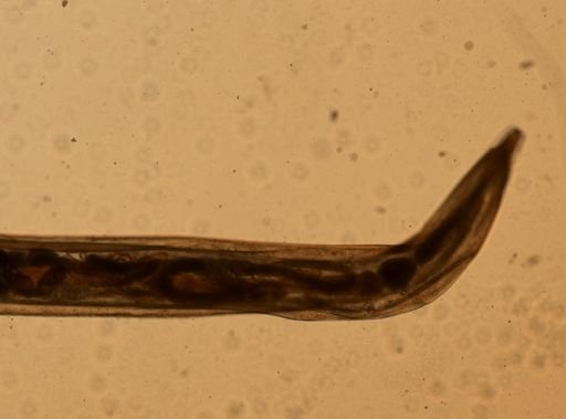 Enterobius vermicularis