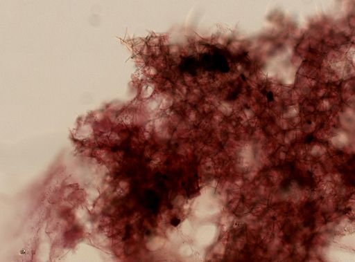 Haliclona (Haliclona)?