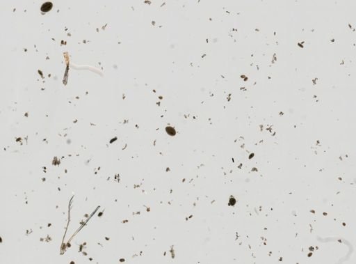 Entodinium
