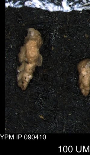 Verneuilina canadensis