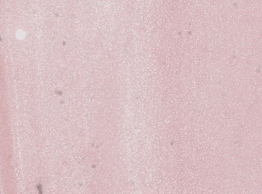 Trypanosoma brucei