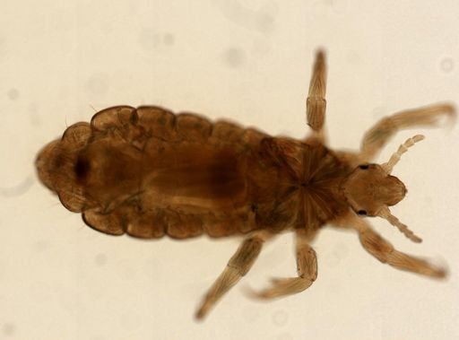 Pediculus humanus