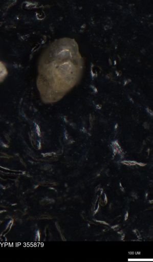 undet. Foraminiferida