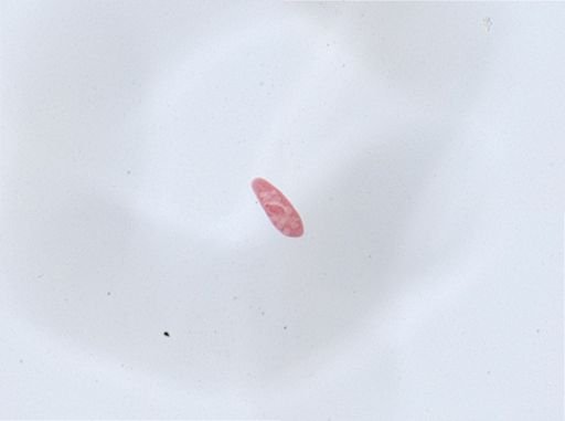 Paramecium aurelia