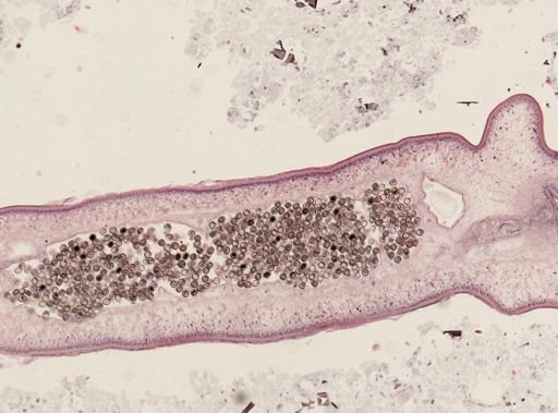 Taenia solium