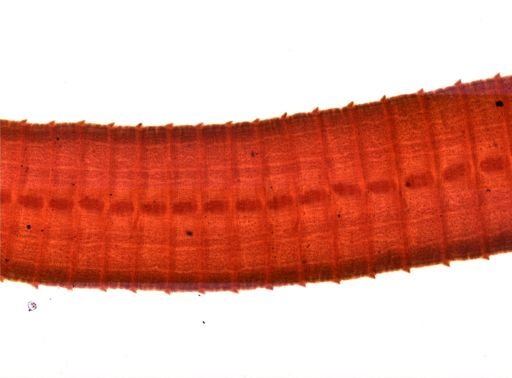 Diphyllobothrium erinacei