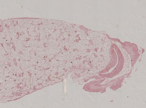 Modiolus