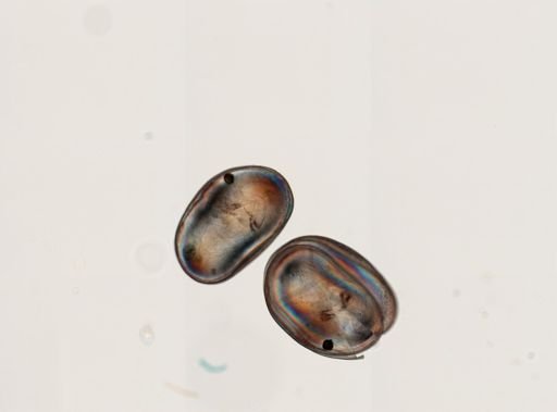 Ostracoda