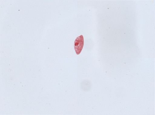 Paramecium aurelia