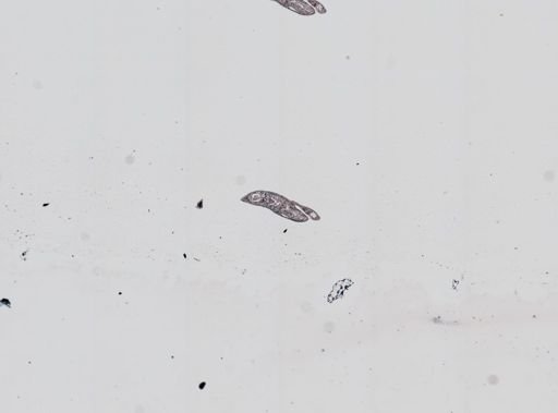 Plagiostomum whitmani