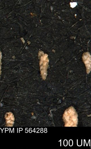 Verneuilina canadensis