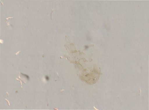 Asterias?
