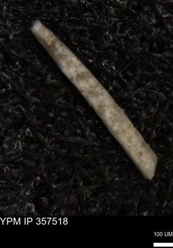 Echinoidea?