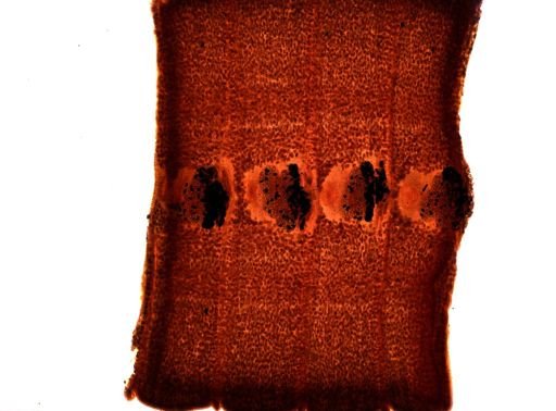 Diphyllobothrium erinacei